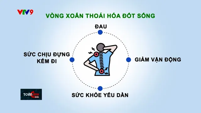 Cảnh báo tốc độ gia tăng và trẻ hoá bệnh nhân thoái hoá đốt sống